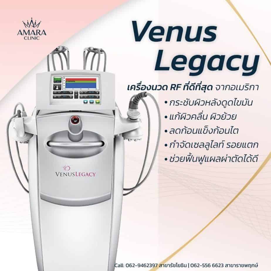 Venus legacy